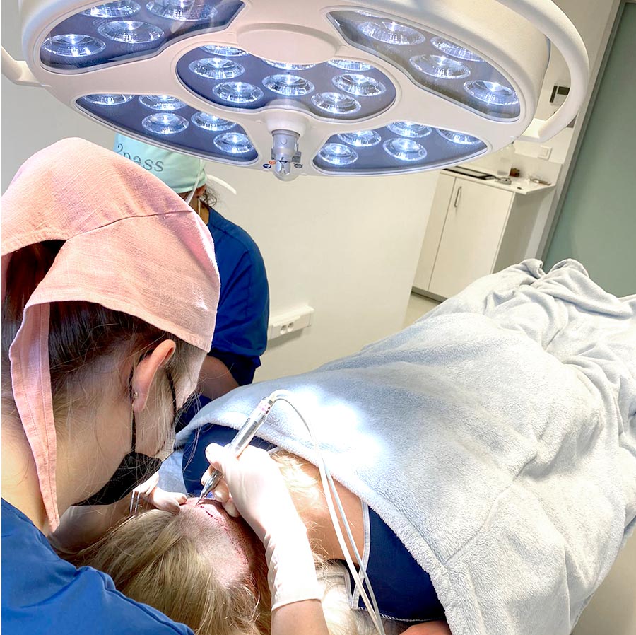 Hoe verzorgt u uw hoofdhuid na een haartransplantatie? - o2 Clinic Hoe verzorgt u uw hoofdhuid na een haartransplantatie? - o2 Clinic