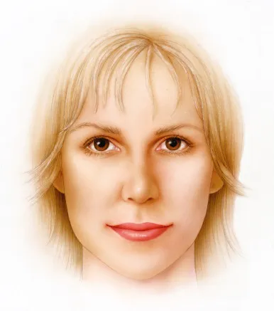 Deep Plane Facelift - o2 Clinic Deep Plane Facelift