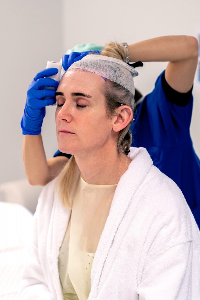 Haartransplantatie - FUE - o2 Clinic Haartransplantatie - FUE - o2 Clinic