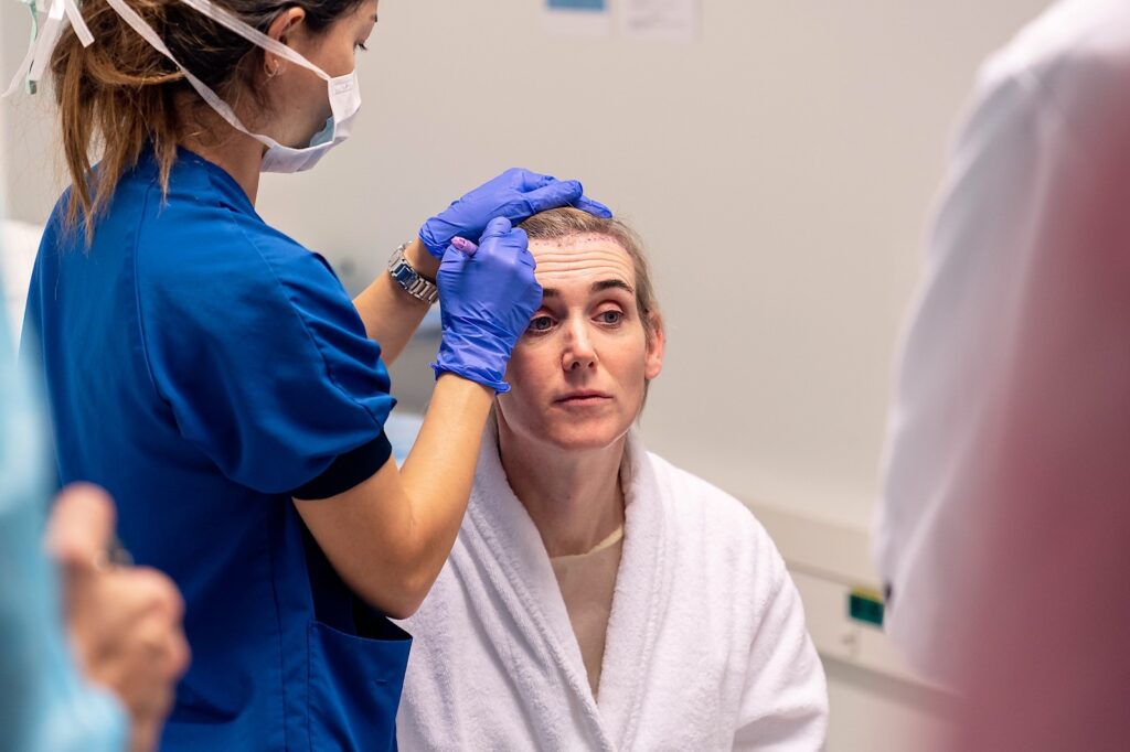 Haartransplantatie - FUE - o2 Clinic Haartransplantatie - FUE - o2 Clinic